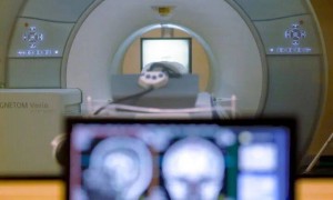 科学家发现逆转大脑衰老“开关”